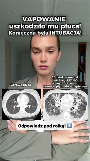 Palisz?😔ZASUBSKRYBUJ po więcej ważnych treści medycznych #zdrowie #lekarz #doktor #szpital #shorts