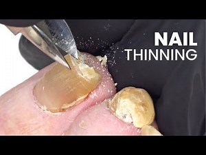 How to Cut Nails + Dry Pedicure