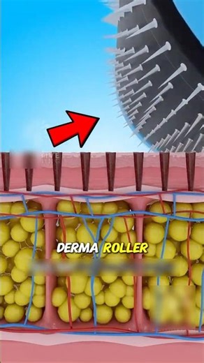 How Does a Derma Roller Work?