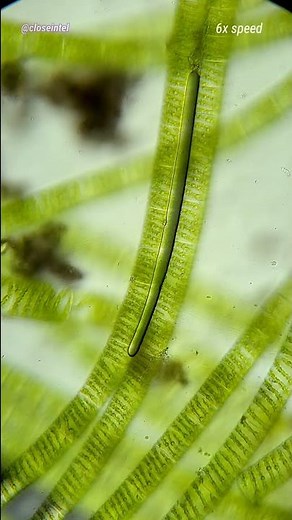 Algae Making Oxygen Under Microscope (Photosynthesis)