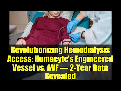 Revolutionizing Hemodialysis Access: Humacyte’s Engineered Vessel vs. AVF – 2-Year Data Revealed