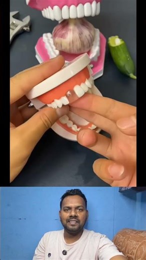 Temporary Tooth Replacement Kit Simple Dental Repair at Home Teeth Whitening Liquid