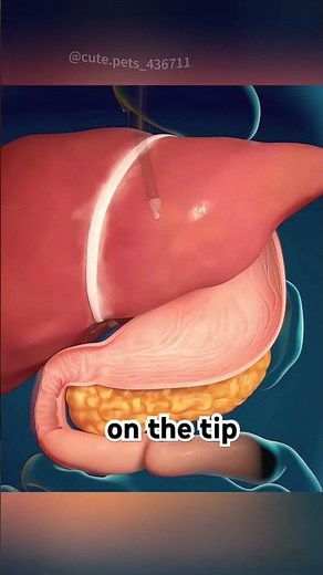 Gastroscopy Procedure(3D Animation) #gastroscopy #endoscopy #medical3d #medicalanimation