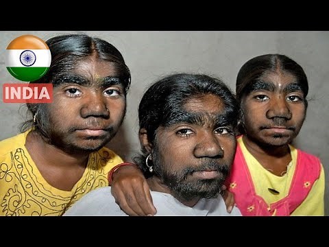 15 Rarest Families With The Most Unusual Body Parts