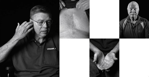 What 100 Million Volts Do to the Body and Mind | The Atlantic