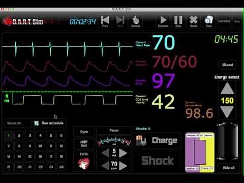 DART ECG Simulator