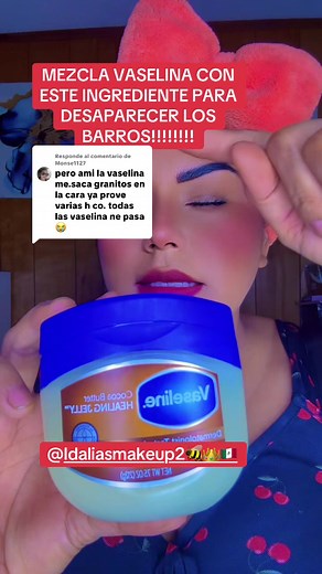 Mezcla vaselina y aceite de ricino para el acné
