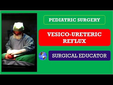 VESICO- URETERIC REFLUX- How To DIAGNOSE & TREAT/ Pediatric Surgery