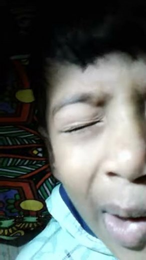 Nocturnal Seizure(Frontal lobe Epilepsy)