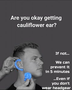 1.2K views | USA WRESTLING & EarSplintz - Cauliflower Ear Treatment...