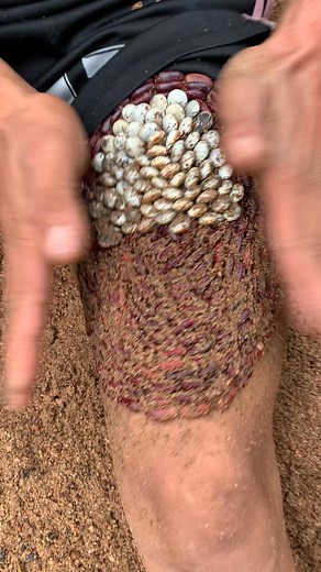 This tick is scary beautiful #ticktokindia #tickso... #funny #ticks #omg | Claudine