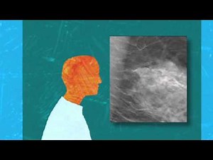 Tomosynthesis & 3D Mammography for Early Detection of Breast Cancer