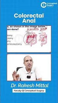 Extended Right Hemicolectomy Explained | Hepatic Flexure Cancer Case 🩺