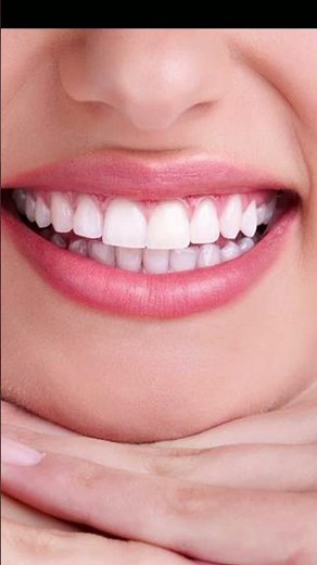 fracture teeth extraction #dentalclinic #dentistdoctor #smiledesigndental