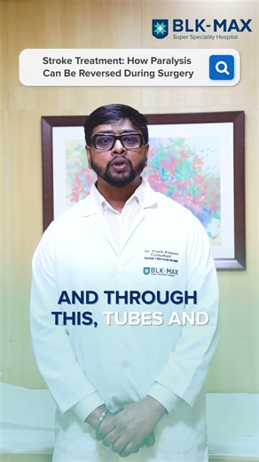 Stroke Treatment: How Paralysis Can Be Reversed During Surgery