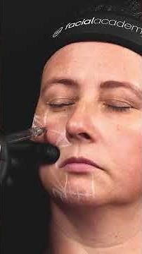 Como escolher o produto por região: full face com HArmonyCA