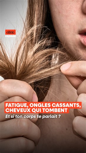 Dans la Tête d’un Coureur on Instagram: "Fatigue qui traîne, ongles cassants, cheveux qui tombent… et si le problème ne venait pas de l’entraînement ? Avec Dr @marinelorphelin_off, on parle alimentation, carences et faux bons réflexes. 📲 Épisode dispo : « Défense Immunitaire & Running : Préparer son corps et éviter les maladies (w. Dr Marine Lorphelin) » ➡️ Sur toutes les plateformes de streaming."