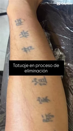 Te compartimos otro proceso de tatuaje en eliminación, este tatuaje este a pocas sesiones de borrarse por completo 🫶🏻 | Dr Tattoo Clinical Studio