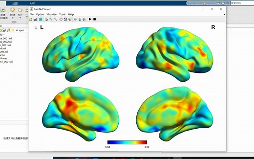 使用Brainnet_View将volume mapping到surface上