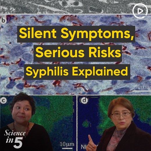 Why are #syphilis cases rising? Who is at risk and how does it spread? Learn about prevention of syphilis from Dr Teodora Elvira Wi in Science in 5. | World Health Organization (WHO)