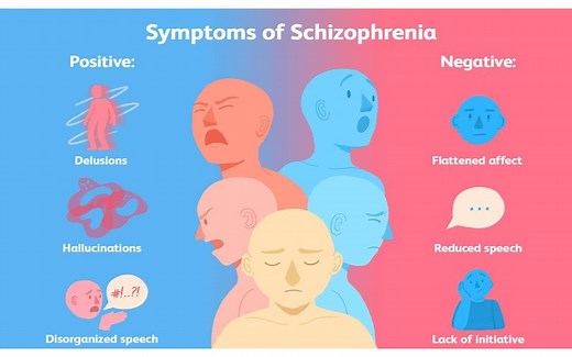 什么是精神分裂？| 精分的阳性&阴性症状 | 幻觉 妄想 无动机 无社交