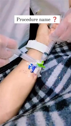 Can you name the procedure? What are the indications & contraindications? #medicalstudent #medlife #highlights #medicine #foryoupageofficiall