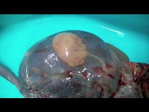 The baby who didnt know he was born