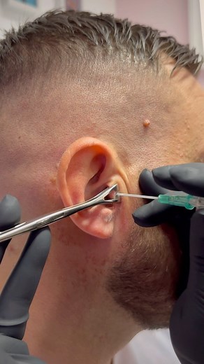 27K views · 474 reactions | Tragus piercing ٠ JUST £15 ⚜️ Gold upgrades available ⚜️ It’s not a Piercing unless it’s Underground! BOOK NOW! Link in bio! @undergroundtattoos Walk-ins available Cash only ⠀ . ⠀ #tragus #traguspiercing #earpiercing #piercing #piercingideas #piercinginspiration #londonpiercing #londonpiercer #watford | Underground Tattoos Watford | Facebook