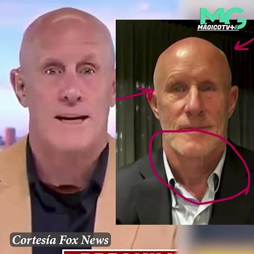 Users perplexed by Robert Harward's neck during interview