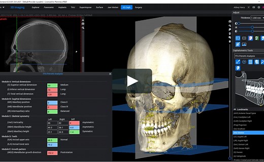 Planmeca Romexis 3D Cephalometry software module