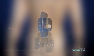 2.7K views · 25 reactions | Spinal cord stimulation (SCS) is an...