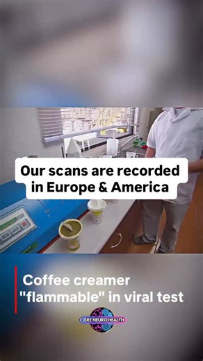 @coreneurohealth1 on Instagram: "That viral test where powdered coffee creamer suddenly bursts into flames isn’t a trick or special effect — it’s basic chemistry. Most powdered creamers aren’t dairy at all. They’re made from refined carbohydrates, processed fats, and added emulsifiers that are engineered to dissolve quickly and last on shelves for years. When these substances are ground into an ultra-fine powder and dispersed into the air, they become highly combustible. This phenomenon is calle