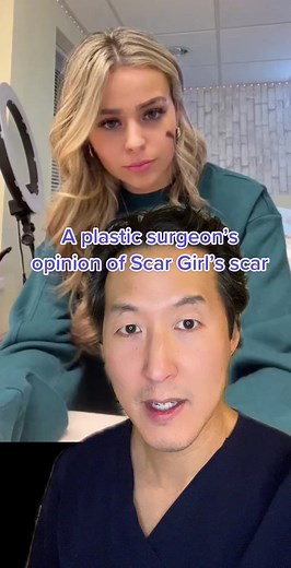Is the Scar Girl’s scar REAL or SUS? Thank you @wtmab for spreading scar awareness and the fact scars don’t take away from anyone’s beauty! #scars #scargirl #scargirlannie #scar #keloid