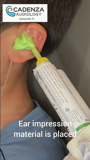 Ear impression for custom hearing devices