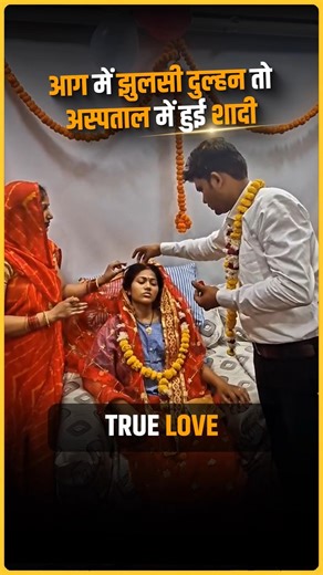 Bride Burned in Fire… Groom Married Her in Hospital