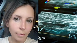 'Tuve cáncer de mama terminal y estas son las 4 señales que desearía nunca haber ignorado'