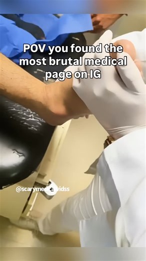 Scary Medical Vids on Instagram: "Follow @scarymedicalvidss for more! 🩺😳"