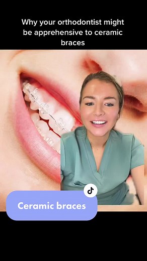 Ceramic Braces: A Comprehensive Guide
