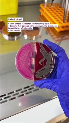 Four common genera of the Enterobacteriaceae family Lab Technician 🧫🔬