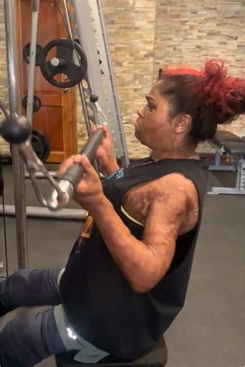 You can make excuses or progress. You choose. #amputeelife #burnsurvivor #amputeeworkout #strengthtraining #weighttraining #doubleamputee #