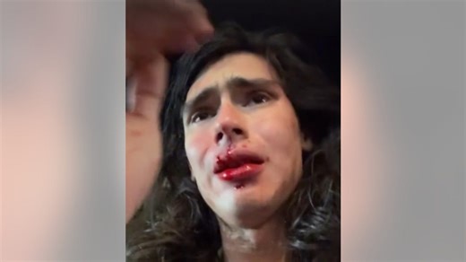 Teen arrested, more suspects sought in alleged hate crime against Colombian model