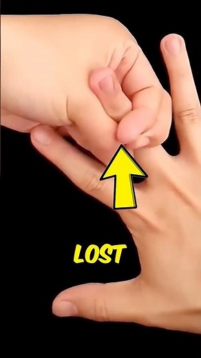 Can You Really Reattach a Finger? 😬🖐️