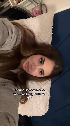 Adult with Baby Teeth: A Unique Dental Case