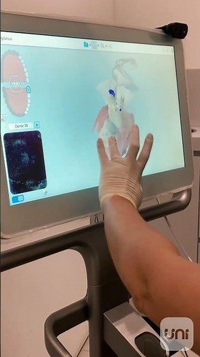 Tecnologia de ponta para o seu sorriso! Scanner iTero Element em ação. ✨🦷