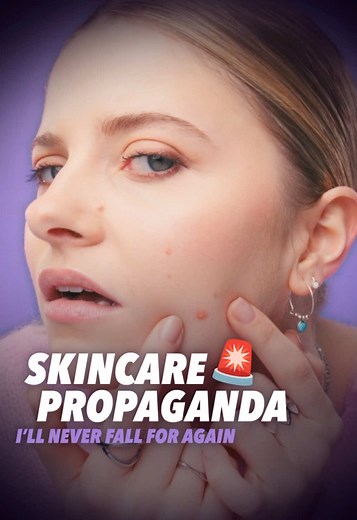 DIY Acne Hacks: What We Learned About Skincare