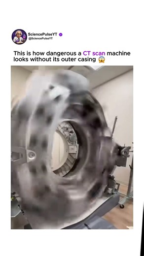 This Is What's Hidden Inside a CT Scanner 🤯