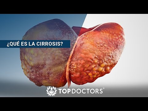 ¿Qué es la Cirrosis?