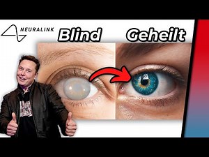 Neuralink Event: Will the blind see and the lame be able to walk again? Elon Musk's brain chip