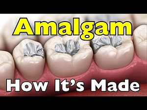 Amalgam: The Secret Formula Behind Dental Fillings & More!