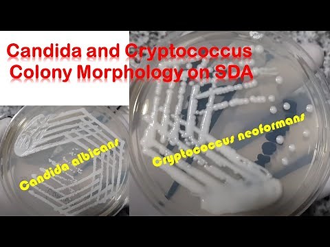 Candida and Cryptococcus colony morphology on SDA